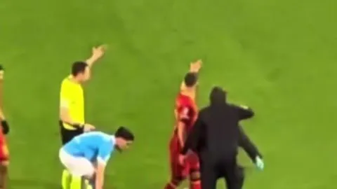 纽卡球员丹-伯恩幼年不幸丧失手指，你察觉到了吗？